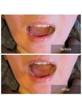 プライミー(PRIMY)/骨格の広がりを「閉める」