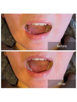 プライミー(PRIMY)/骨格の広がりを「閉める」