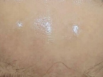 ワン(ONE.)の写真/「嘘みたいにキレイになれる!!」と話題の【本物志向】の方にオススメする最新の美肌特化メニューをご用意♪