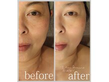 アン グレーヌ 自由が丘(unegraine)/輪郭はスッキリ、頬はふっくら