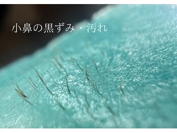 モカラ(MOKARA)/小鼻悩みは毛だった・・・？？！