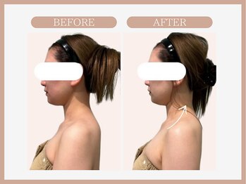 スリムライン 青森店(The Slim Line)/before→after