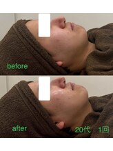 グラシア(gracia)/レモンボトル