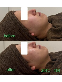 グラシア(gracia)/レモンボトル