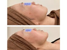 リュクスアンドコー 上田店(Luxe&co.)/【レモンボトル】