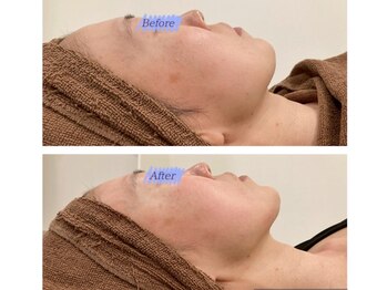 リュクスアンドコー 上田店(Luxe&co.)/【レモンボトル】