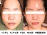 〈1ランク上の艶美肌ならコレ〉”韓国“で人気沸騰【水光肌フェイシャル】