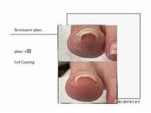 ナトゥーラ(NatuLa)の雰囲気（ネイルも充実！特殊なプレート使用して巻き爪改善も◎）