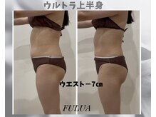 フルーア(FULUA)/ウルトランスフォーマー上半身