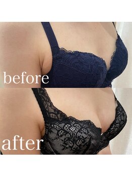 ディーソワン(De-soin)/