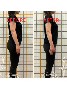 アイユーサロン(愛YOUsalon)の写真/【運動なし・過度な食事制限なし・リバウンドなし】90日で7kgから10kgを目指すダイエット☆