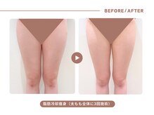 イエス マイサロン(yes My Salon)の雰囲気(【脂肪冷却で徹底痩身】冷やして脂肪細胞ごと減らす最先端技術)