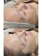 クレヴィー(Creviy)/最先端の細胞美容コース