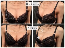 パフューム(Perfume)/