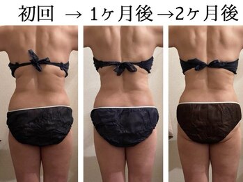 サロン ド ユキフラン(Salon de Yukifranc)/施術部位→お腹・ウエスト・腰