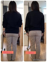 リボーン アオヤマ(Re-born aoyama)/整体ビフォーアフター