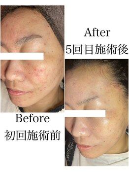 ブラックボックス(BLACK BOX)/30代女性のお客様