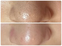 カピリナ(ka pilina)/加工なし、このリアル感！