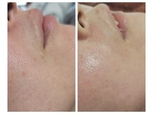 エスボーテ(sbeaute)/ヌクレールフェイシャルワックス