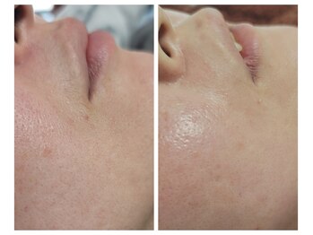 エスボーテ(sbeaute)/ヌクレールフェイシャルワックス