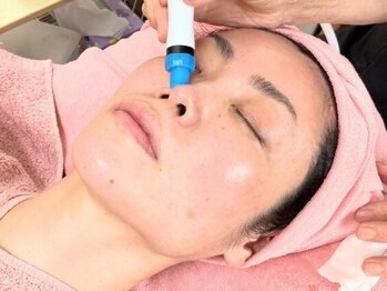 サイエンス アイの写真/韓国式ハイドロピーリングで毛穴レス!剥離無し★毛穴の黒ずみ,メイク残りによる皮脂汚れもしっかり除去!