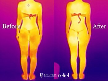 リフィール たまプラーザ店(refiel)/見えるインディバの力