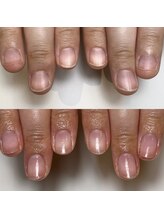 ロイヤル ネイルサロン(Royal nail Saloon)/コンプレックスを解消