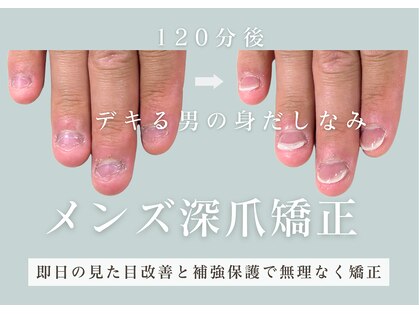 ヴェールリム(verl lim)の写真