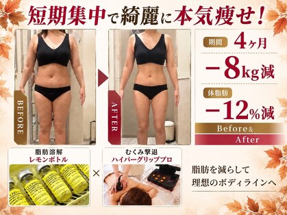 クリニカルエステ イーズ あべのキューズタウン店の写真