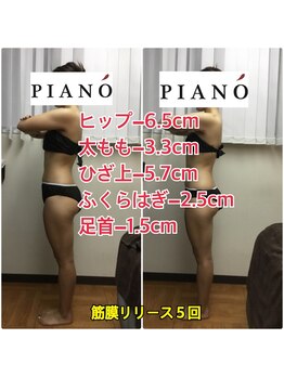 ピアーノ(PIANO)/筋膜リリース