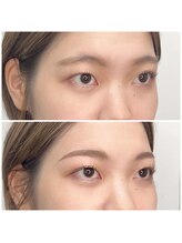 アイコン 小倉店(EYECON)/アイブロウワキシングケア