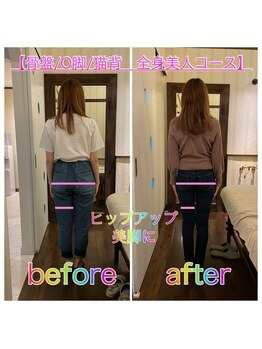 ヒカリノキュウジツ(Hikarino休日)/ヒップアップ、美脚ビフォアフ