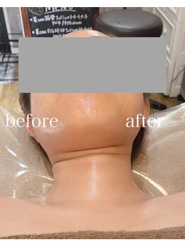 ブリリアントライフ(Blilyant life)/美 zen筋骨フェイシャルTr.