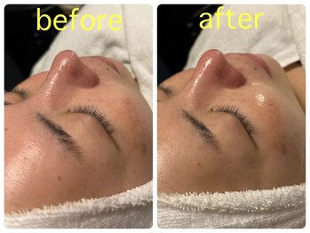 ベルドア(Bell Door)/AHAピーリング／くすみ／キメ