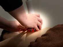 アリビオ(Alivio)/LEDライトで美肌に！