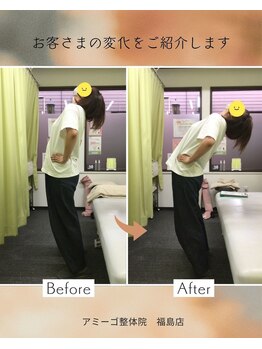 アミーゴ整体院/ビフォーアフター