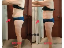 ビューティーエッセンス 都立大学(BEAUTY ESSENCE)/あきらめないで～！