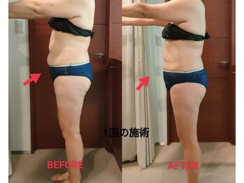 ビューティーエッセンス 都立大学(BEAUTY ESSENCE)/あきらめないで~!