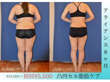 アンシャンテ姫路の雰囲気（痩身メニューお任せください！結果重視でお手入れいたします☆）