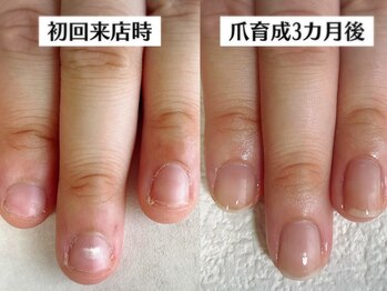 自爪育成３ヶ月後