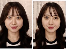 タカハナ(TAKAHANA)/施術後の