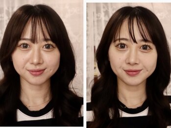 タカハナ(TAKAHANA)/施術後の