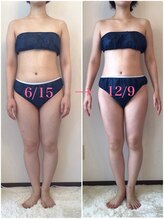 ビューティー サロン ハナ(Beauty Salon hana)/むくみがスッキリ美脚☆施術6回