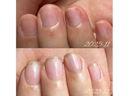 ネイルプルーフ(NAIL proof)の写真