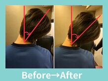 こころ整骨院/２0代男性のビフォーアフター