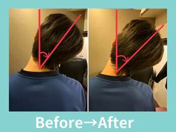 こころ整骨院/２0代男性のビフォーアフター