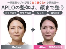 アプロ(APLO)