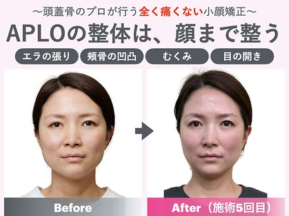 アプロ(APLO)の写真