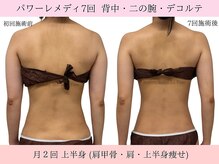 ラエッセ(La Esse)/背中のお肉さようなら