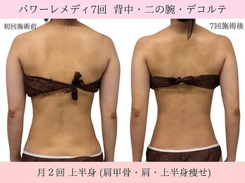 ラエッセ(La Esse)/背中のお肉さようなら